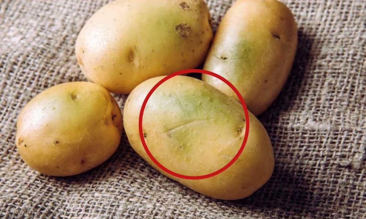 আলুর গায়ে সবুজ দাগ দেখেও খাচ্ছেন, পরিণতি কী?